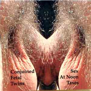 Conjoined Fetal Twins - Sex At Noon Taxes download flac mp3