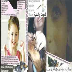 Cerebral Roil / Dental Work - Split download flac mp3