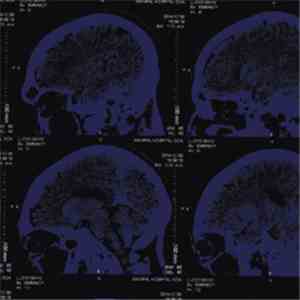The Nightingales - Mind Over Matter download flac mp3