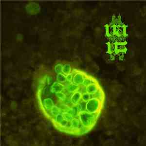 Vaus - Coccidioidomycosis download flac mp3