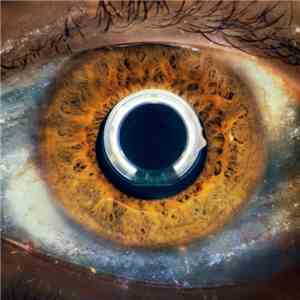 I Cani - Aurora download flac mp3