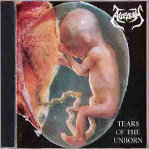 Apoplexy  - Tears Of The Unborn / Dysmorphophobia download flac mp3