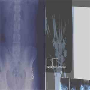 Recoil - Unsound Remixes download flac mp3