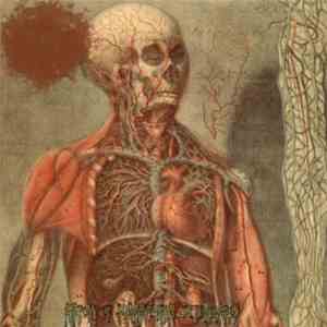 Reglan Induced Drug Intoxication - Anatomy of Pharmaceutical Deterioration download flac mp3