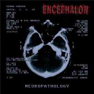 Encephalon  - Neuropathology download flac mp3