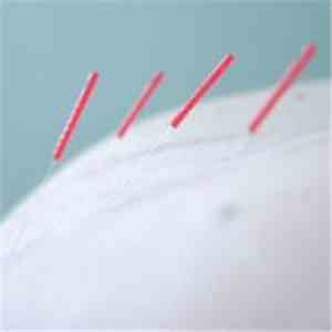 Moderntronica - Electronic Acupuncture download flac mp3