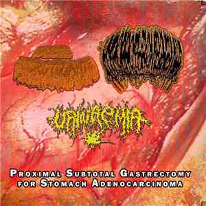 Fascitis Necrotizante, Urinaemia, Hypoprothrombinemia - Proximal Subtotal Gastrectomy For Stomach Adenocarcinoma download flac mp3