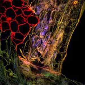 Various - Bacterium download flac mp3
