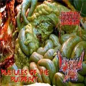 Black Mold Phallanx, Lacerated Tissue - Pustules of the Putrifact download flac mp3