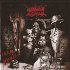 Bradi Cerebri Ectomia - Supreme Heterozis download flac mp3