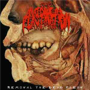 Anatomical Plastination - Removal The Dead Flesh download flac mp3